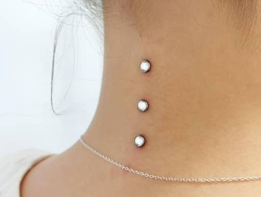 Microdermal